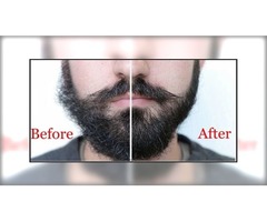 Best Quick Beard Straightener Brush | free-classifieds.co.uk - 3