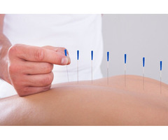 Boost Your Health by Acupuncture in Beckenham | free-classifieds.co.uk - 1