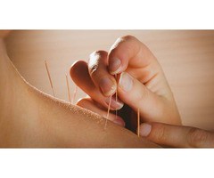 Need for Acupuncture Treatments in Street Liverpool? | free-classifieds.co.uk - 1