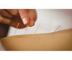 Need for Acupuncture Treatments in Street Liverpool? | free-classifieds.co.uk - 3
