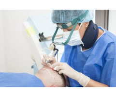 Safe and Fast Hair Transplant Treatment in the UK - 2