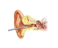 Ear infection treatments Liverpool | free-classifieds.co.uk - 1