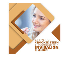 Get Your Crooked Teeth Straightened with Invisalign in London | free-classifieds.co.uk - 1