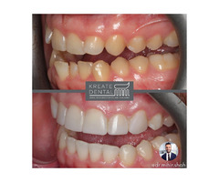 Kreate Dental Dartford | free-classifieds.co.uk - 1