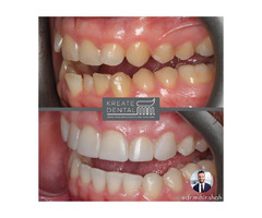 Kreate Dental Dartford | free-classifieds.co.uk - 3