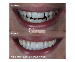 Love Teeth Dental - Stonecot | free-classifieds.co.uk - 3