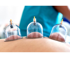 Ginkgo Health Clinic: Best Cupping Therapy in London  | free-classifieds.co.uk - 1